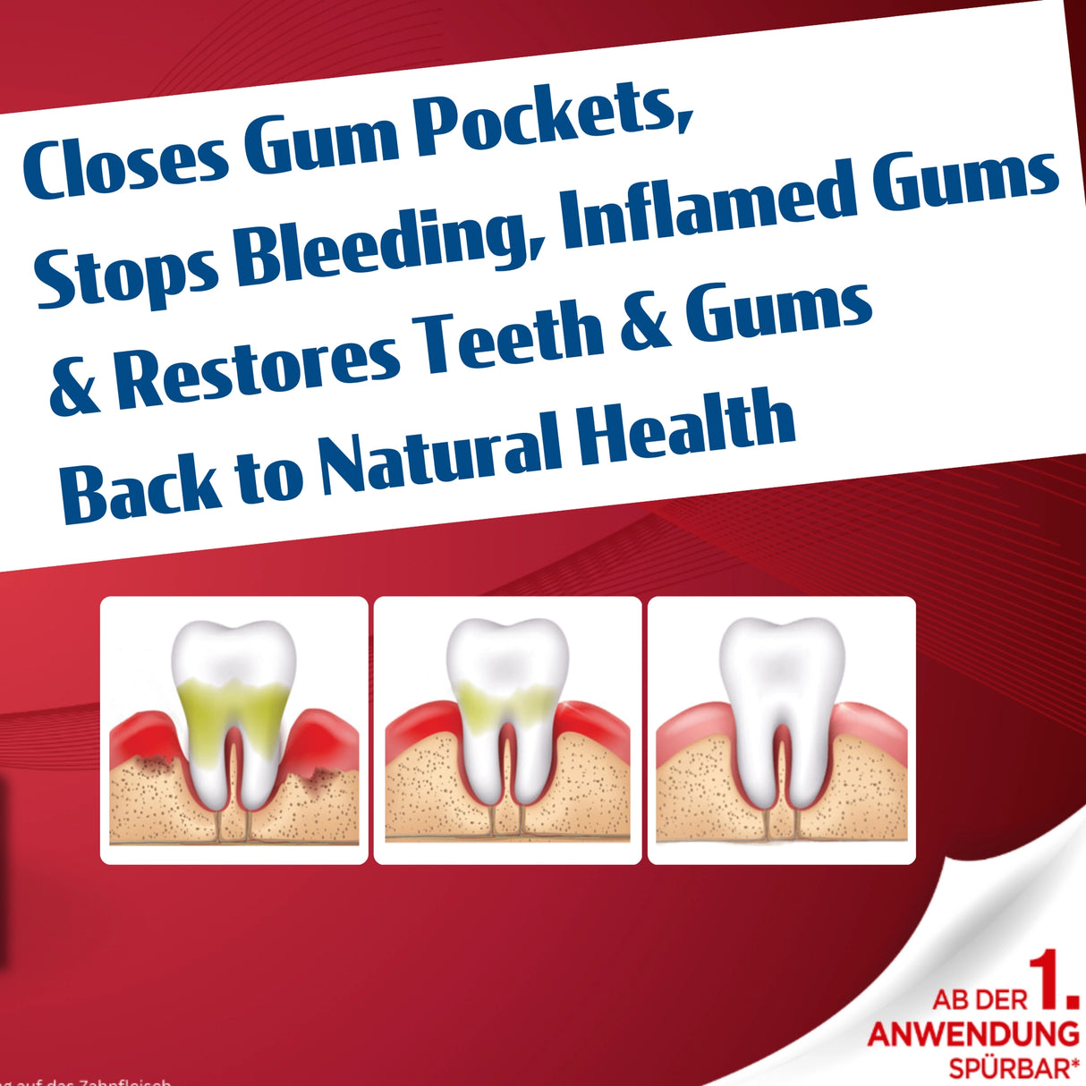 Advertisement for dental product with text and illustrations of teeth and gums on a red and white background.