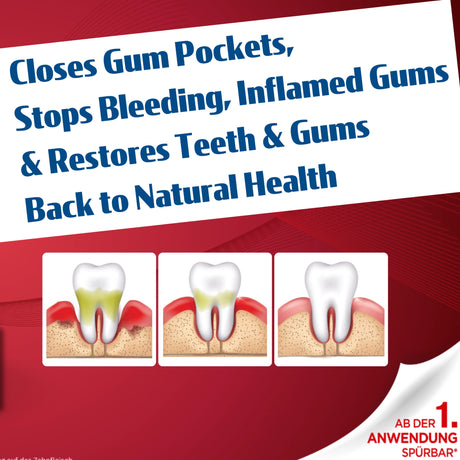 Advertisement for dental product with text and illustrations of teeth and gums on a red and white background.
